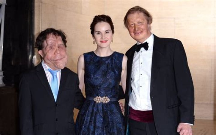 Adam Pearson Wife: Unveiling the Life, Love, and Journey