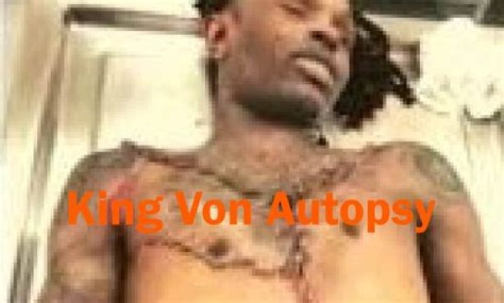 King Von Autopsy Picture: The Truth Behind the Scenes