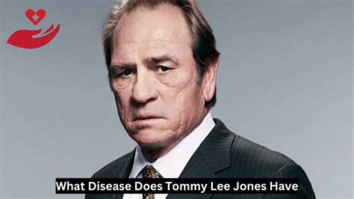 What Disease Does Tommy Lee Jones Have? A Comprehensive Look at His Health and Legacy